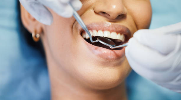 Best Emergency Treatment for Toothache in Bridgewater, VA
