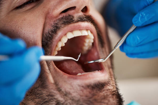 Best Same-Day Emergency Dentist in Bridgewater, VA