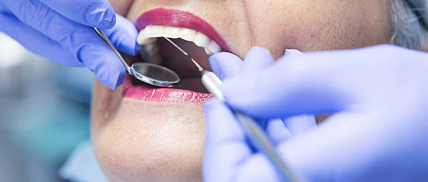 Best Emergency Wisdom Teeth Removal in Bridgewater, VA